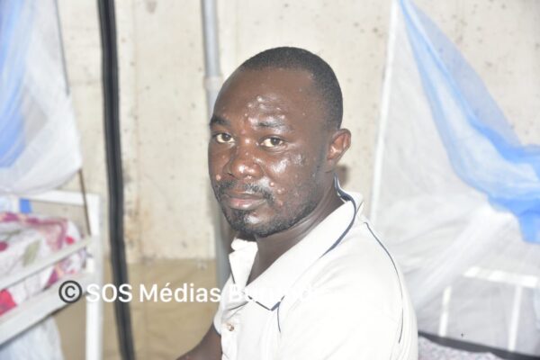 Goma: karibu vifo thelathini na zaidi ya watu 3,800 walioathiriwa na janga la tumbili huko Kivu Kaskazini.