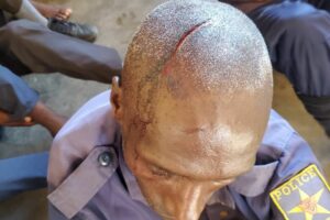 Un policier issu de la communauté Banyamulenge blessé à la tête par des miliciens Wazalendo, dans le territoire d’Uvira (RD Congo), le mercredi 11 juin 2025. Il faisait partie d’un groupe intercepté et torturé alors qu’il se rendait à Bijombo sous escorte burundaise © DR